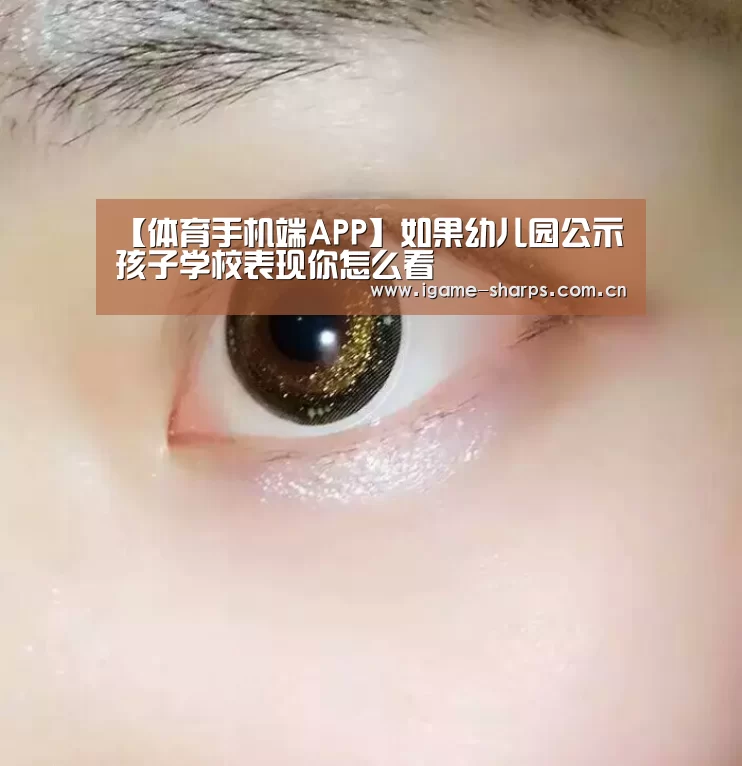 【体育手机端APP】如果幼儿园公示孩子学校表现你怎么看(图2)